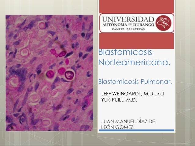 blastomicosis pulmonar